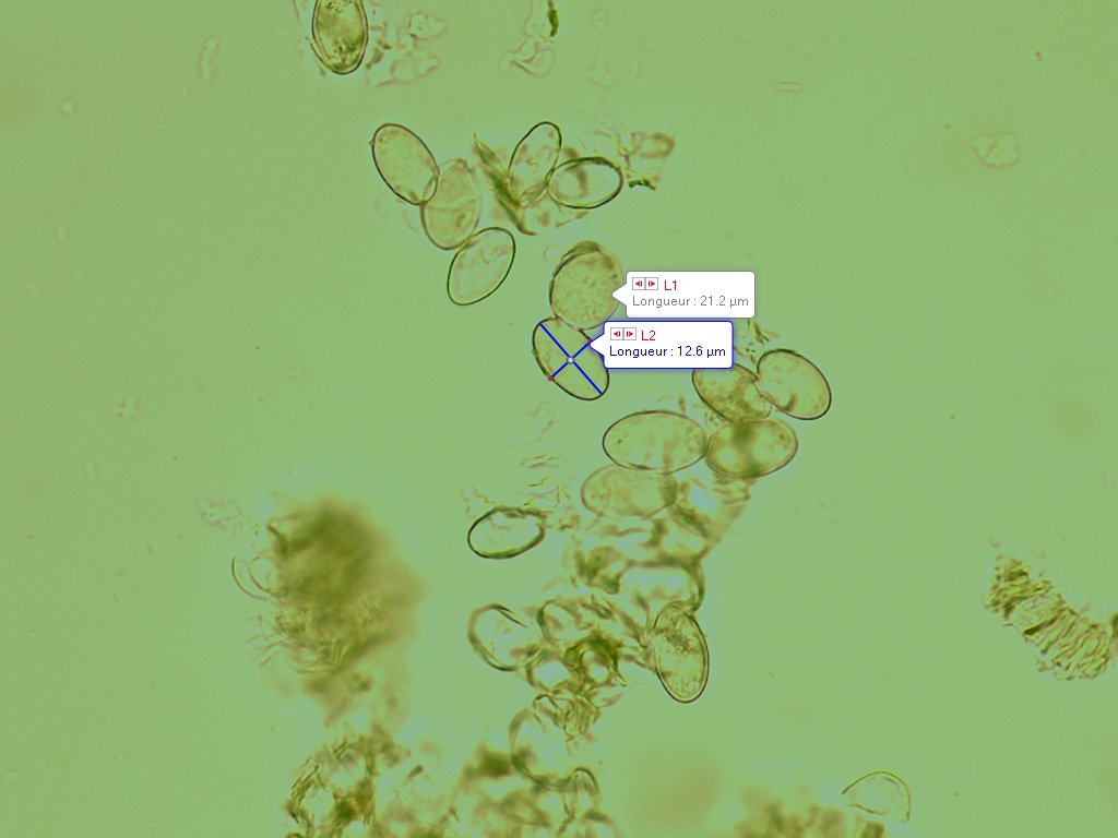 Disciotis venosa spores 2