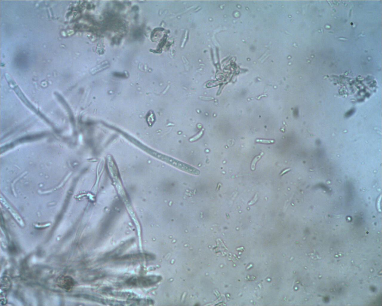 Encoelia furfuracea spores