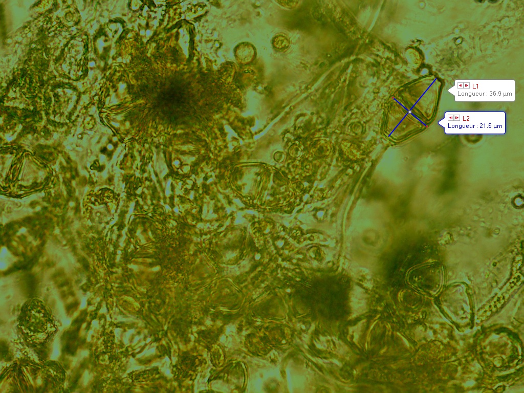Gymnosporangium tremelloides spores basides 3 2020 05 12