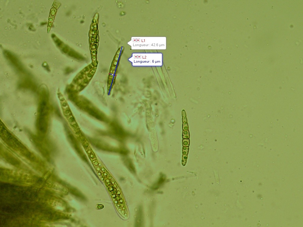 Leptosphaeria acuta spores