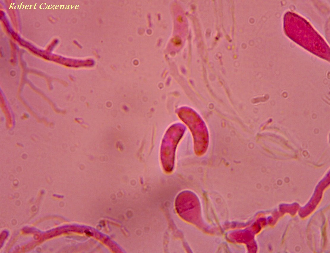 Myxarium nucleatum spores