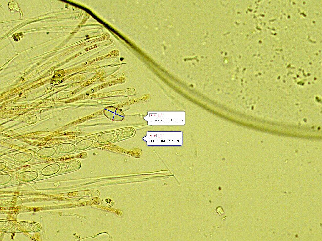 Pseudaleuria fibrillosa 2020 09 11 paraphyses asque 11