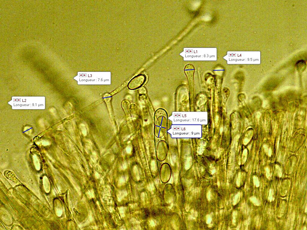 Pseudaleuria fibrillosa 2020 09 11 paraphyses spores 2