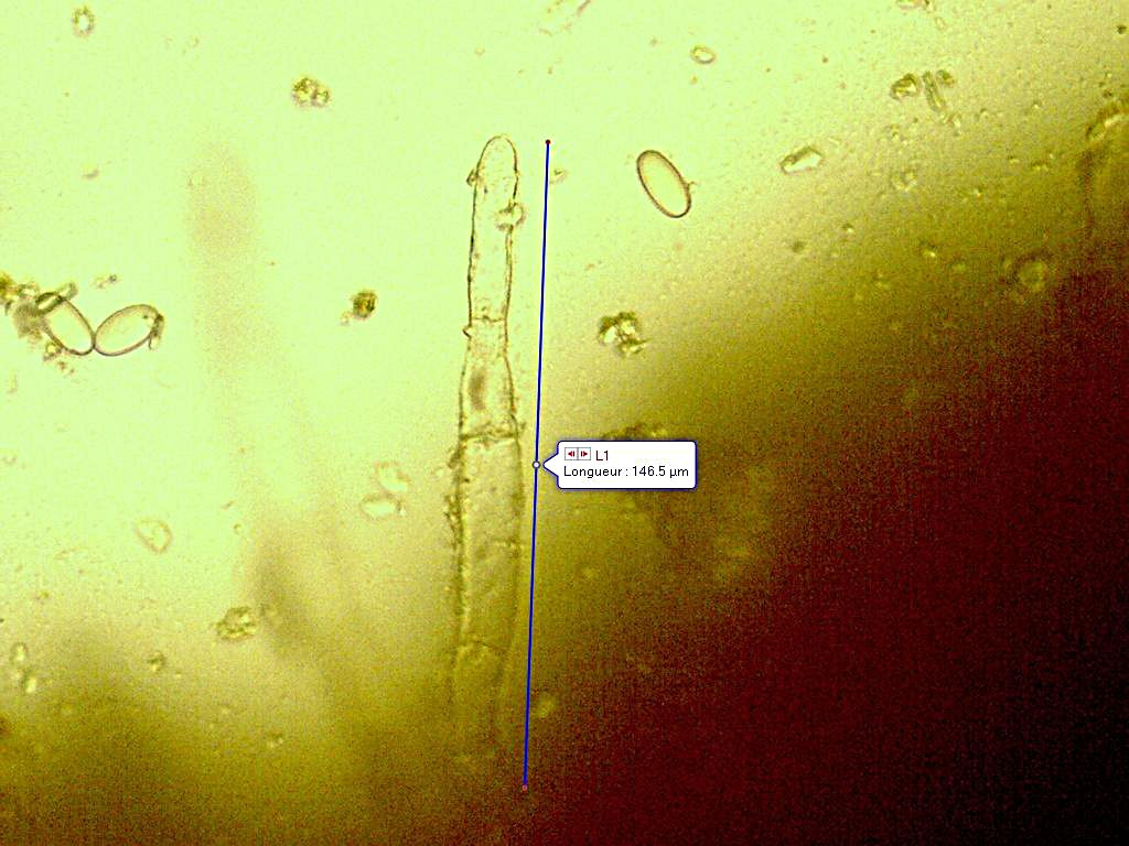 Pseudaleuria fibrillosa 2020 09 11 poils marginaux 12