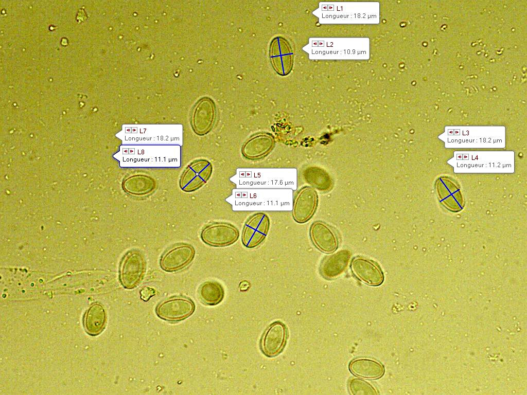 Pseudaleuria fibrillosa 2020 09 11 spores 1