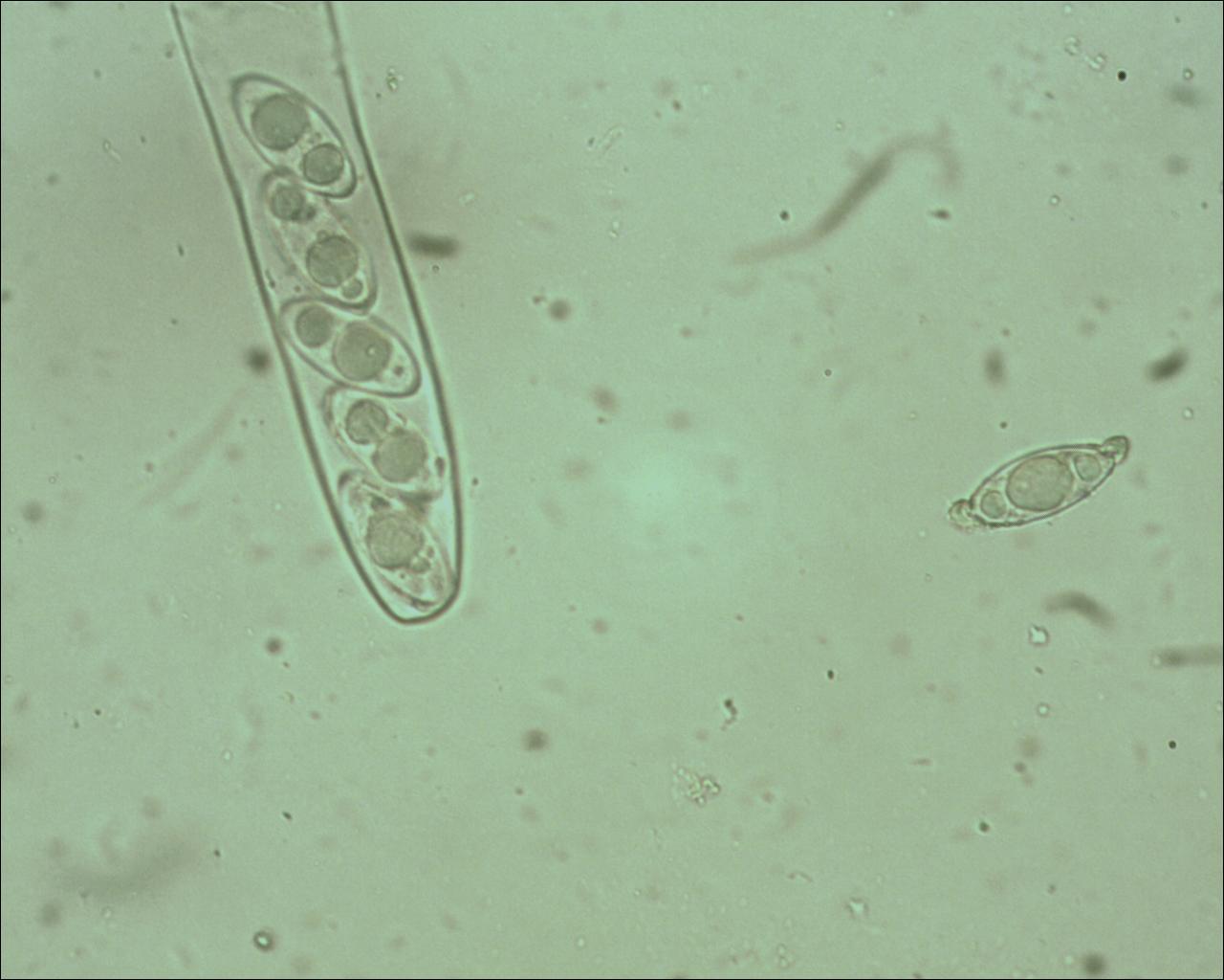 discina perlata spore