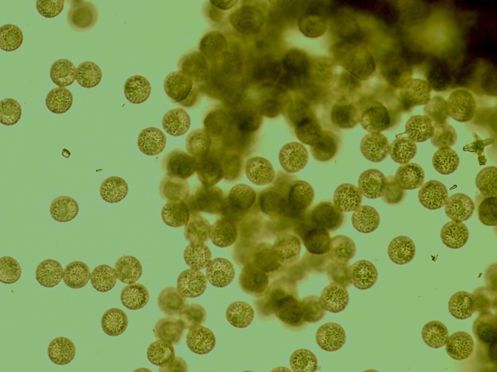 Mucilago crustacea spores 1