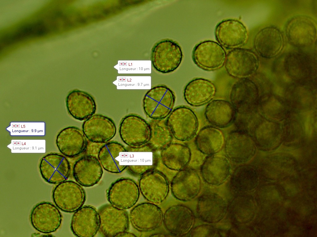 TRichia  persimilis spores 3