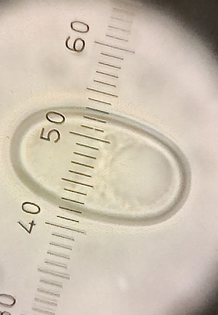 4 A. babingtonii spore l = 11 12 µ